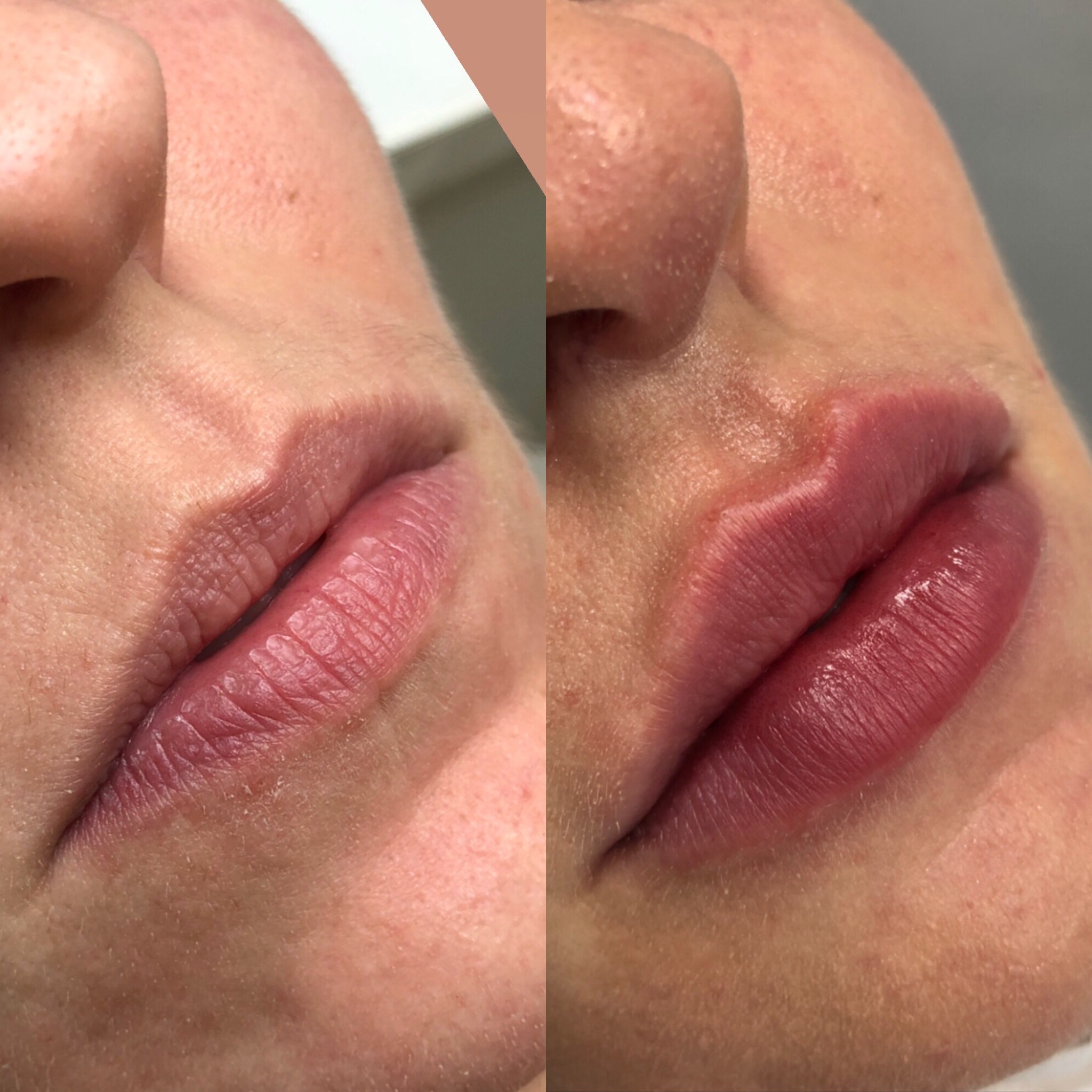 Resultado4-clinica-rica